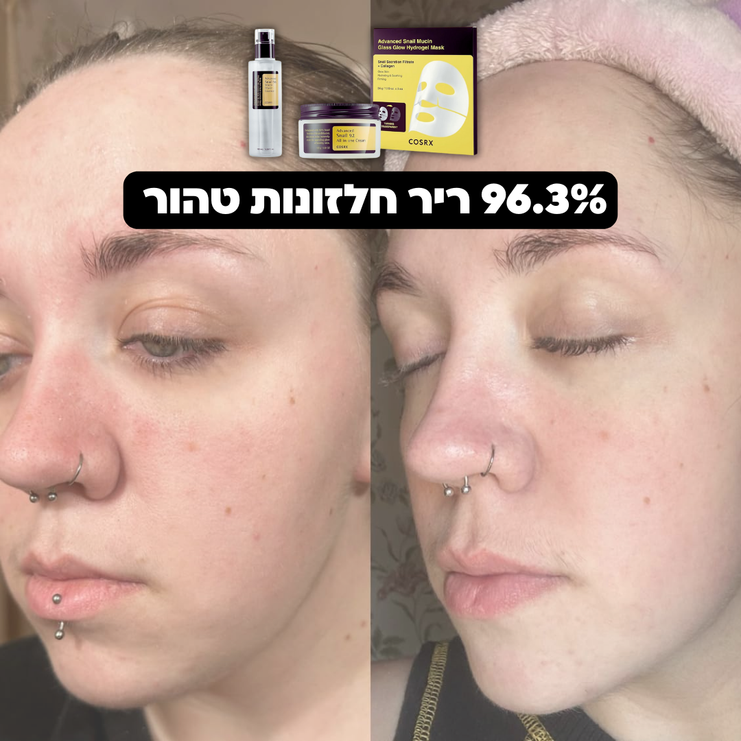 סט אנטי אייג'ינג COSRX: סרום + קרם עם ריר חלזונות קוריאני