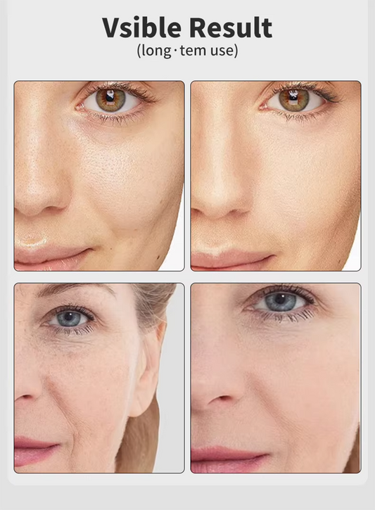 מכשיר אנטי-אייג’ינג ביתי – טיפול ב־7 צבעי LED למיצוק והבהרת העור