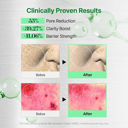 VT Reedle Shot 50/100 (Liquid Microneedle Serum) - glow82