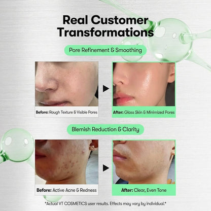 VT Reedle Shot 50/100 (Liquid Microneedle Serum) - glow82